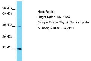 Host: Rabbit Target Name: RNF113A Sample Tissue: Human Thyroid Tumor Antibody Dilution: 1ug/ml (RNF113A 抗体  (N-Term))