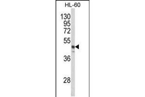 Western blot analysis of SNX6 Antibody in HL-60 cell line lysates (35ug/lane)