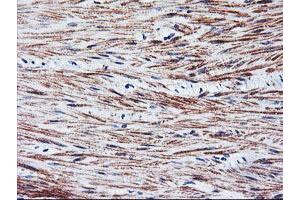 Immunohistochemical staining of paraffin-embedded Human colon tissue using anti-TAL1 mouse monoclonal antibody.