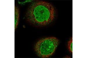 Immunofluorescent staining of human cell line A-431 shows positivity in nucleus but not nucleoli & nuclear membrane. (PHF20 抗体)