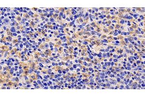 Detection of TSLP in Human Spleen Tissue using Monoclonal Antibody to Thymic Stromal Lymphopoietin (TSLP) (Thymic Stromal Lymphopoietin 抗体  (AA 29-159))