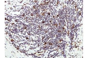 Immunohistochemical staining of paraffin-embedded Human lymph tissue using HICE1 antibody at a dilution of 1:50 (NYS48/HAUS8 抗体)