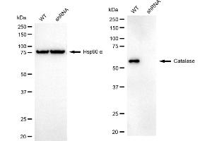 Western blotting analysis using Catalase antibody (ABIN7797918). (Recombinant Catalase 抗体)