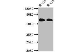 Western Blot Positive WB detected in: Rat brain tissue, Mouse brain tissue All lanes: SLC1A2 antibody at 3. (SLC1A2 抗体  (AA 460-574))