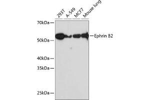 Western blot analysis of extracts of various cell lines, using Ephrin B2 Rabbit mAb (ABIN7266978) at 1:1000 dilution. (Ephrin B2 抗体)