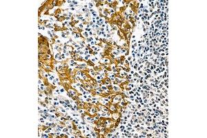 Immunohistochemistry analysis of paraffin embedded human tonsil using CK6 (ABIN7074423) at dilution of 1: 1000 (Keratin 6 抗体)