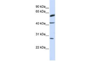 Western Blotting (WB) image for anti-Ring Finger Protein 170 (RNF170) antibody (ABIN2458738) (RNF170 抗体)