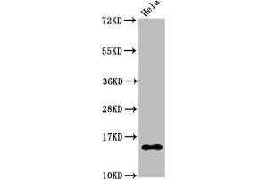 Western Blot Positive WB detected in Hela whole cell lysate treated by 15 mM sodium butyrate for 30 min All lanes Acetyl-Histone H2B type 1-B(K20)antibody at 0.