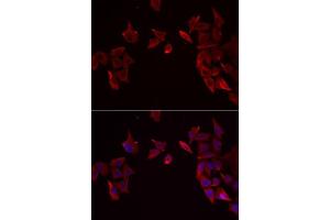 Immunofluorescence analysis of MCF7 cells using RAMP3 antibody.