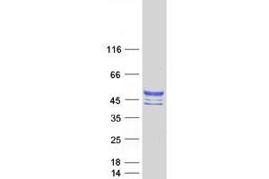 Western Blotting (WB) image for Carbohydrate Sulfotransferase 10 (CHST10) protein (Myc-DYKDDDDK Tag) (ABIN2714185)