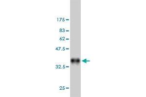 Western Blot detection against Immunogen (35. (DAPK2 抗体  (AA 281-370))