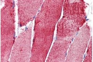Human Skeletal Muscle: Formalin-Fixed, Paraffin-Embedded (FFPE) (ACTN3 抗体  (AA 180-229))