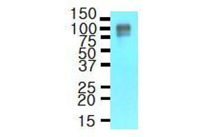 Western Blotting (WB) image for anti-Amyloid beta (A4) Precursor Protein (APP) (AA 18-289) antibody (ABIN317496) (APP 抗体  (AA 18-289))
