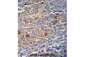 Immunohistochemistry (IHC) image for anti-Chromosome 9 Open Reading Frame 156 (C9orf156) antibody (ABIN3002894) (C9orf156 抗体)