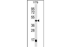 Western blot analysis in Y79 cell line lysates (35ug/lane). (MAP2K4 抗体  (C-Term))
