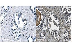 IHC analysis of OB Cadherin/CDH11 using anti-OB Cadherin/CDH11 antibody (ABIN5518978).