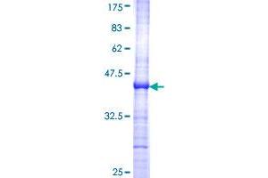 Image no. 1 for Fibroblast Growth Factor 10 (FGF10) (AA 38-137) protein (GST tag) (ABIN1353995)