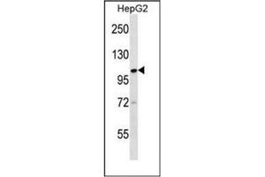 Western blot analysis of KIF18A Antibody (C-term) in HepG2 cell line lysates (35ug/lane). (KIF18A 抗体  (C-Term))