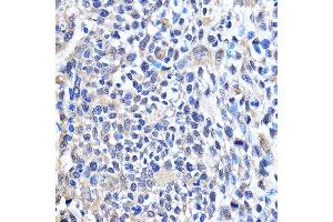 Immunohistochemistry of paraffin-embedded Human esophageal using CDK6 Rabbit pAb (ABIN7266595) at dilution of 1:100 (40x lens). (CDK6 抗体  (AA 1-326))