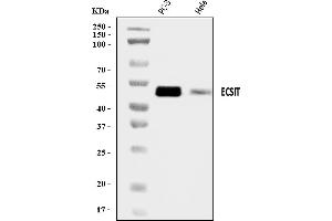 Western blot analysis of ECSIT using anti-ECSIT antibody (ABIN7602543).