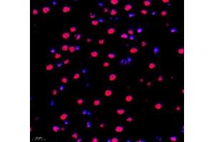 Immunofluorescence (Paraffin-embedded Sections) (IF (p)) image for anti-Poly A Binding Protein Nuclear 1 (PABPN1) antibody (ABIN7075116)