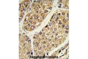 Immunohistochemistry (IHC) image for anti-Chondroitin Sulfate N-Acetylgalactosaminyltransferase 2 (CSGALNACT2) antibody (ABIN3003905) (CSGALNACT2 抗体)