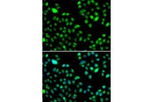 Immunofluorescence analysis of MCF-7 cells using L3MBTL3 antibody. (L3MBTL3 抗体)