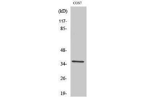 Western Blotting (WB) image for anti-FBJ Murine Osteosarcoma Viral Oncogene Homolog B (FOSB) (Ser392) antibody (ABIN3184648) (FOSB 抗体  (Ser392))