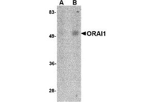 Western Blotting (WB) image for anti-ORAI Calcium Release-Activated Calcium Modulator 1 (ORAI1) (C-Term) antibody (ABIN492546) (ORAI1 抗体  (C-Term))