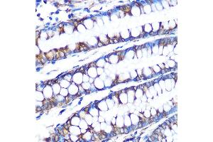 Immunohistochemistry of paraffin-embedded human colon using LOX Rabbit mAb (ABIN7268347) at dilution of 1:100 (40x lens). (LOX 抗体)