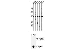 Image no. 1 for anti-Tumor Protein P53 (TP53) (pThr18) antibody (ABIN358195) (p53 抗体  (pThr18))