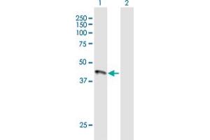 Western Blot analysis of HFE expression in transfected 293T cell line by HFE MaxPab polyclonal antibody. (HFE 抗体  (AA 1-348))