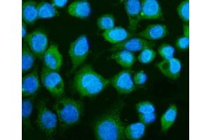 IF analysis of CGAS using anti-CGAS antibody (ABIN7600586).