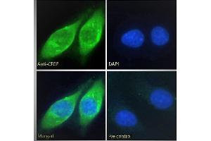 ABIN6391343 Immunofluorescence analysis of paraformaldehyde fixed HepG2 cells, permeabilized with 0. (CTGF 抗体  (AA 111-123))