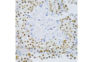 Immunohistochemistry of paraffin-embedded mouse testis using SNRNP70 antibody. (SNRNP70 抗体  (AA 150-250))