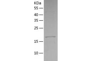 Western Blotting (WB) image for Mesoderm Development Candidate 2 (MESDC2) (AA 34-234) protein (His tag) (ABIN7123917) (MESDC2 Protein (AA 34-234) (His tag))