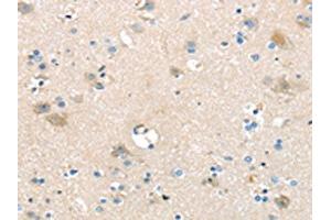 Immunohistochemistry (IHC) image for anti-Solute Carrier Family 16, Member 11 (Monocarboxylic Acid Transporter 11) (SLC16A11) antibody (ABIN7192395)