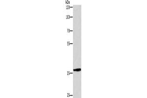 Gel: 8 % SDS-PAGE, Lysate: 40 μg, Lane: Hela cells, Primary antibody: ABIN7190518(DUSP2 Antibody) at dilution 1/300, Secondary antibody: Goat anti rabbit IgG at 1/8000 dilution, Exposure time: 1 minute (DUSP2 抗体)