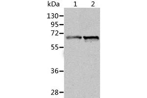 Western Blot analysis of Human fetal liver and liver cancer tissue using ALDH4A1 Polyclonal Antibody at dilution of 1:450 (ALDH4A1 抗体)