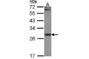 WB Image Sample (30 ug of whole cell lysate) A: A431 , 12% SDS PAGE Carbonyl reductase 1 antibody antibody diluted at 1:1000 (CBR1 抗体  (C-Term))