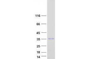 Validation with Western Blot (ZFAND5 Protein (Transcript Variant B) (Myc-DYKDDDDK Tag))
