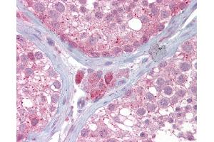 Anti-UBE2L3 antibody IHC of human testis. (UBE2L3 抗体  (AA 35-84))