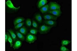 Immunofluorescent analysis of A549 cells using ABIN7167819 at dilution of 1:100 and Alexa Fluor 488-congugated AffiniPure Goat Anti-Rabbit IgG(H+L) (RAI1 抗体  (AA 617-823))