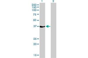 Western Blot analysis of RAD51 expression in transfected 293T cell line by RAD51 monoclonal antibody (M01), clone 2E5-E5. (RAD51 抗体  (AA 1-242))