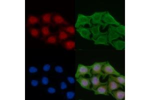 ABIN6259040 and ABIN6274387 staining Hela cells(45 min of heat-shock) by IF/ICC.