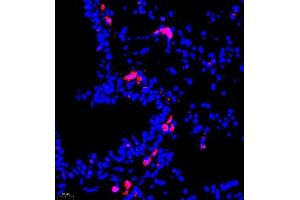 Immunofluorescence of paraffin embedded mouse lung using MHC-II (ABIN7074245) at dilution of 1:500 (400x lens) (CD74 抗体)