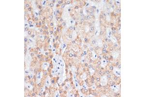 Immunohistochemistry of paraffin-embedded human liver using AREG antibody (ABIN6127431, ABIN6137065, ABIN6137066 and ABIN6216408) at dilution of 1:100 (40x lens). (Amphiregulin 抗体  (AA 20-252))