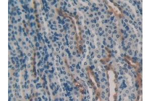 Detection of HSPA1B in Mouse Kidney Tissue using Polyclonal Antibody to Heat Shock 70 kDa Protein 1B (HSPA1B) (HSPA1B 抗体  (AA 1-642))