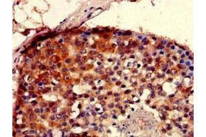 Immunohistochemistry (IHC) image for anti-SEC23 Interacting Protein (SEC23IP) (AA 779-989) antibody (ABIN7168659)