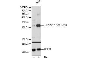 Western blot analysis of extracts of HeLa cells, using Phospho-HSP27/HSPB1-S78 pAb (ABIN3019892, ABIN3019893, ABIN3019894 and ABIN1681665) at 1:1000 dilution or HSP27/HSPB1 antibody (ABIN7267568). (HSP27 抗体  (pSer78))